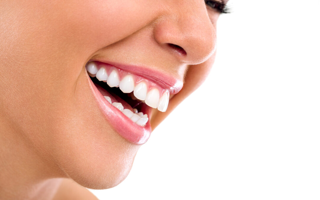 Implantes dentales, carga inmediata